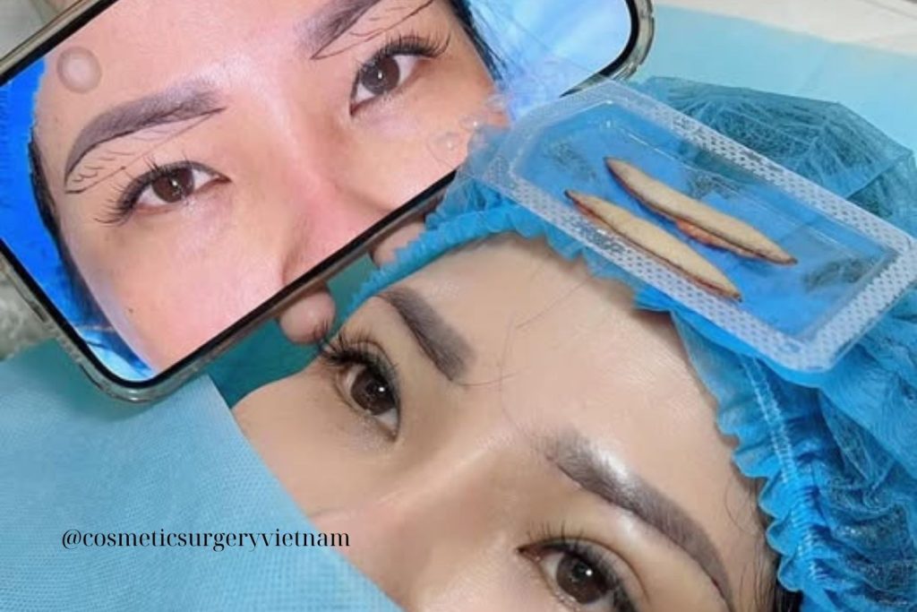 Bản sao của Before (2) Ban Sao Cua Before 2 2 1024x683