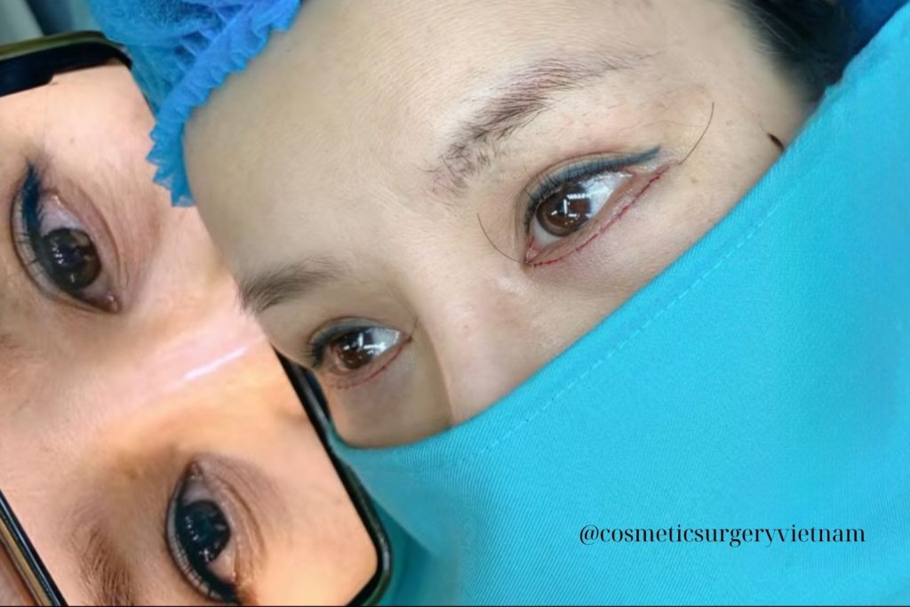 Bản sao của Before (4) Ban Sao Cua Before 4 1024x683