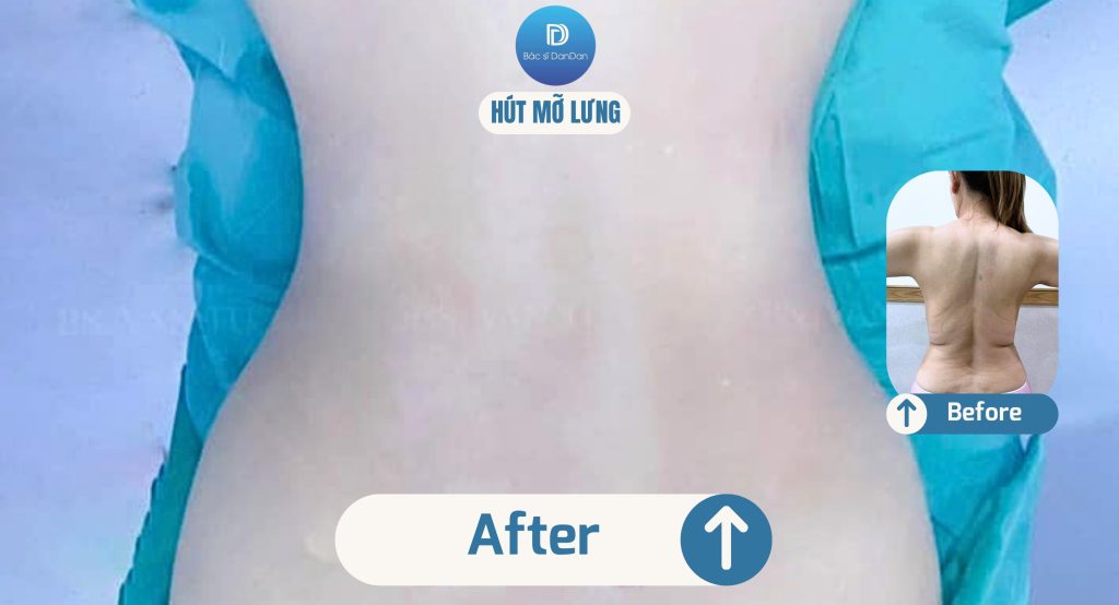 Before (3) Before 3 1 1024x554