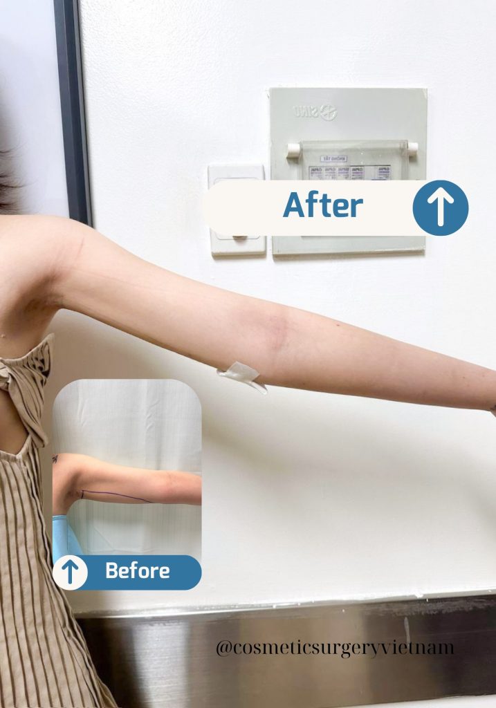 Before (3) Before 3 2 717x1024