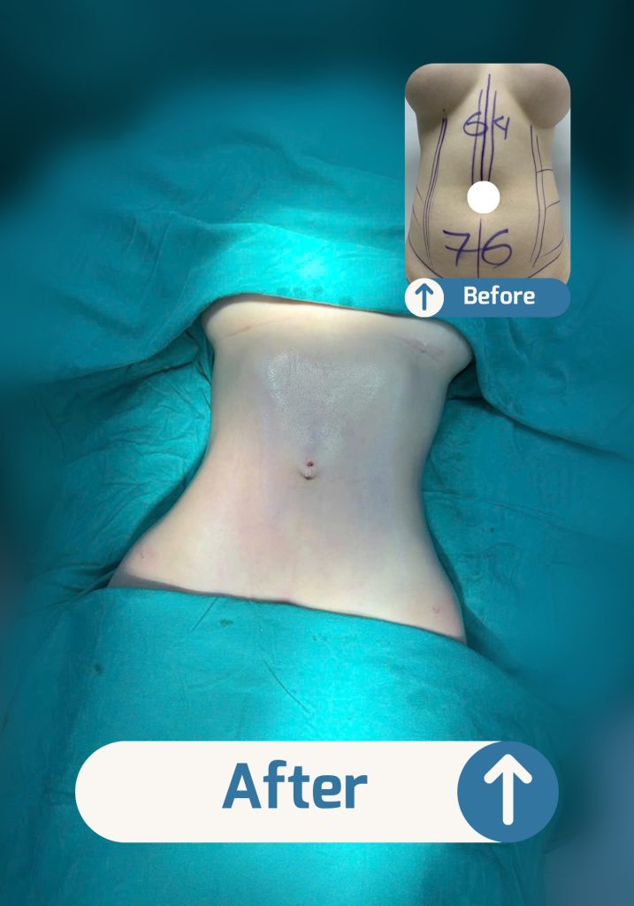 Before (4) Before 4 717x1024