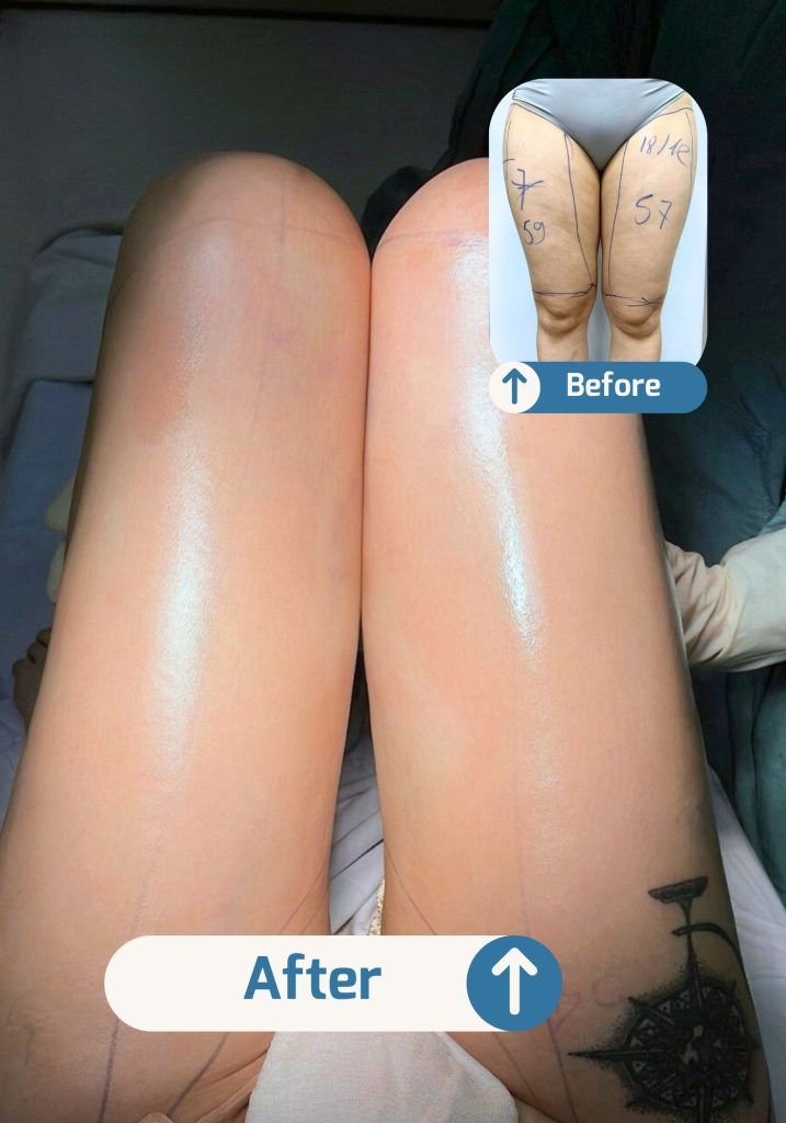 Before (6) Before 6 717x1024