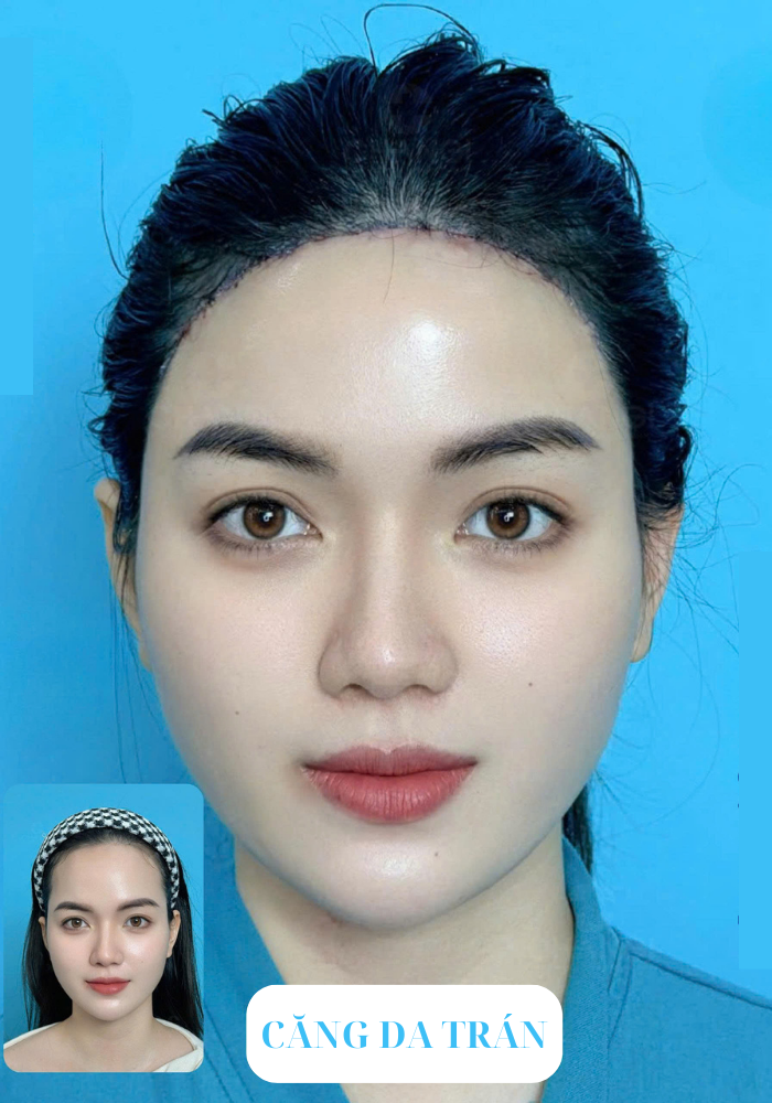 CĂNG DA TRÁN CANG DA TRAN