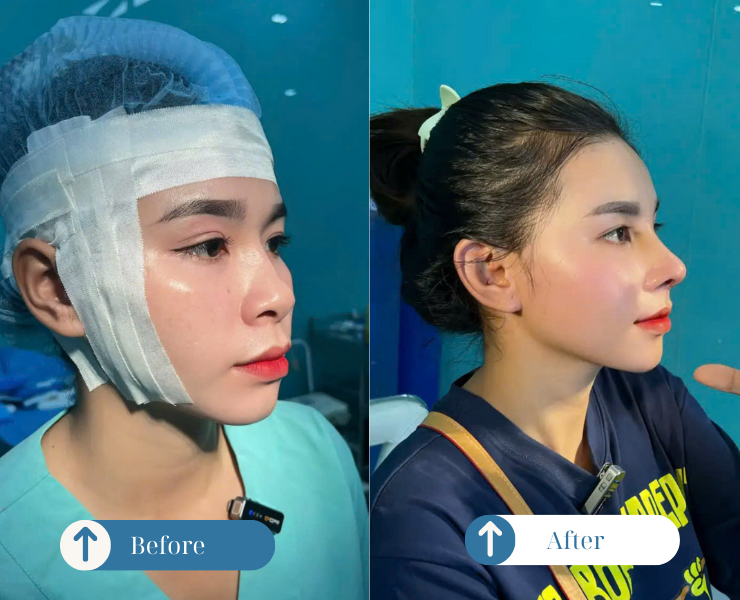 HINH VUONG NHO WEB 1 3