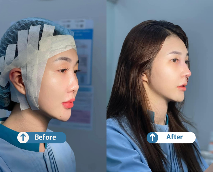 HINH VUONG NHO WEB 2 3