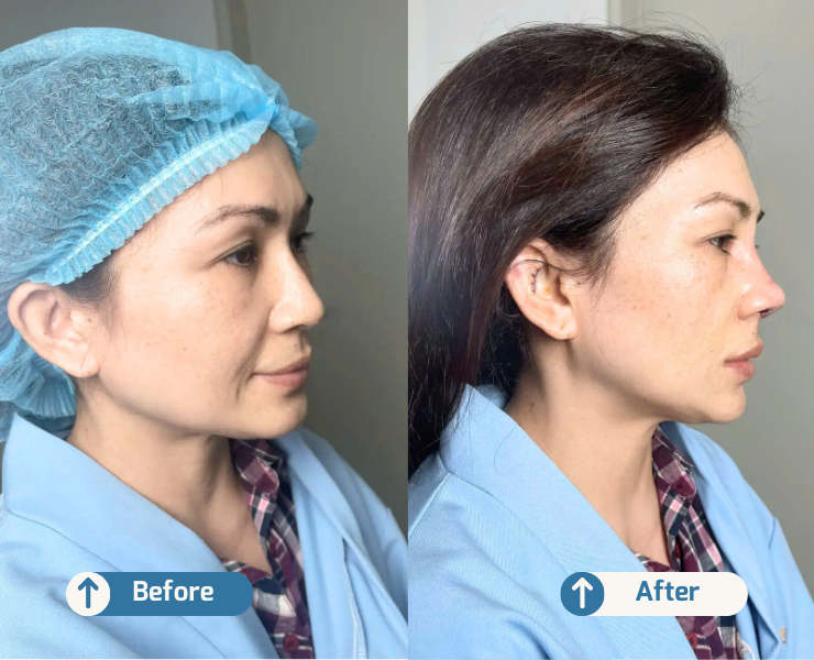 HINH VUONG NHO WEB 3 1