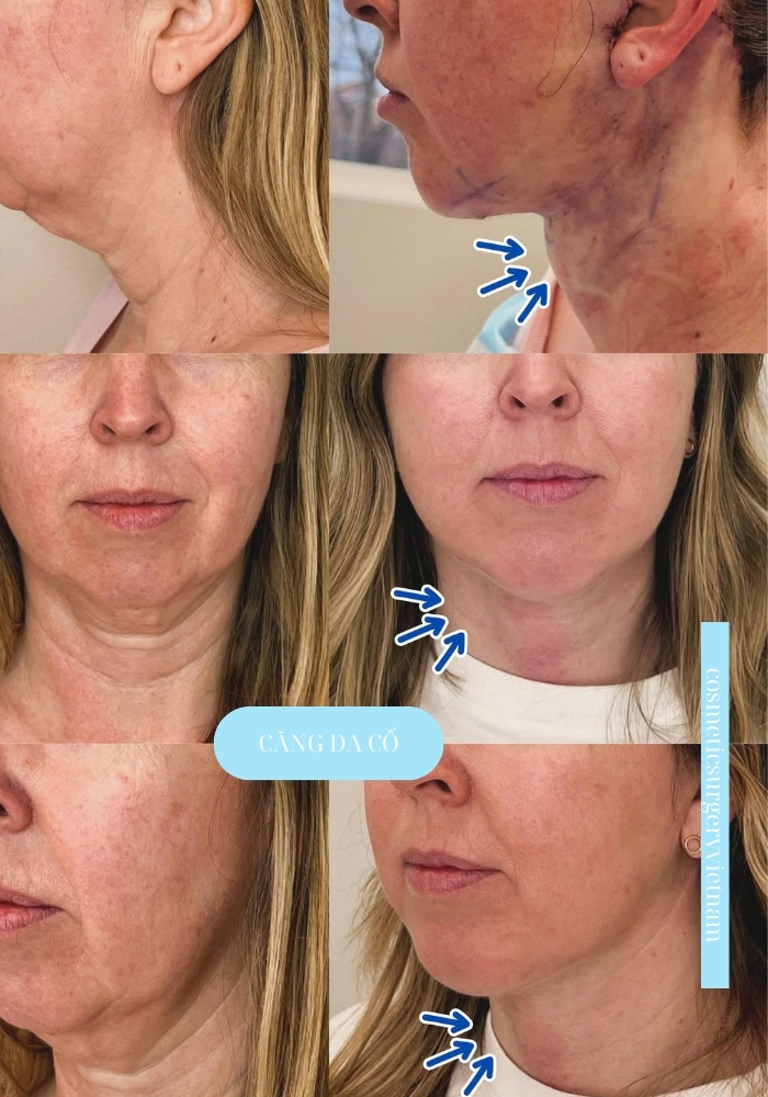 Thêm nội dung văn bản (1) Them Noi Dung Van Ban 1 1