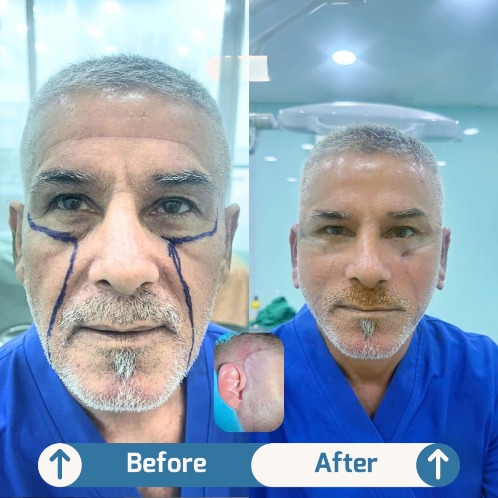 Thiết kế chưa có tên Thiet Ke Chua Co Ten